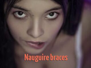 Nauguire_braces